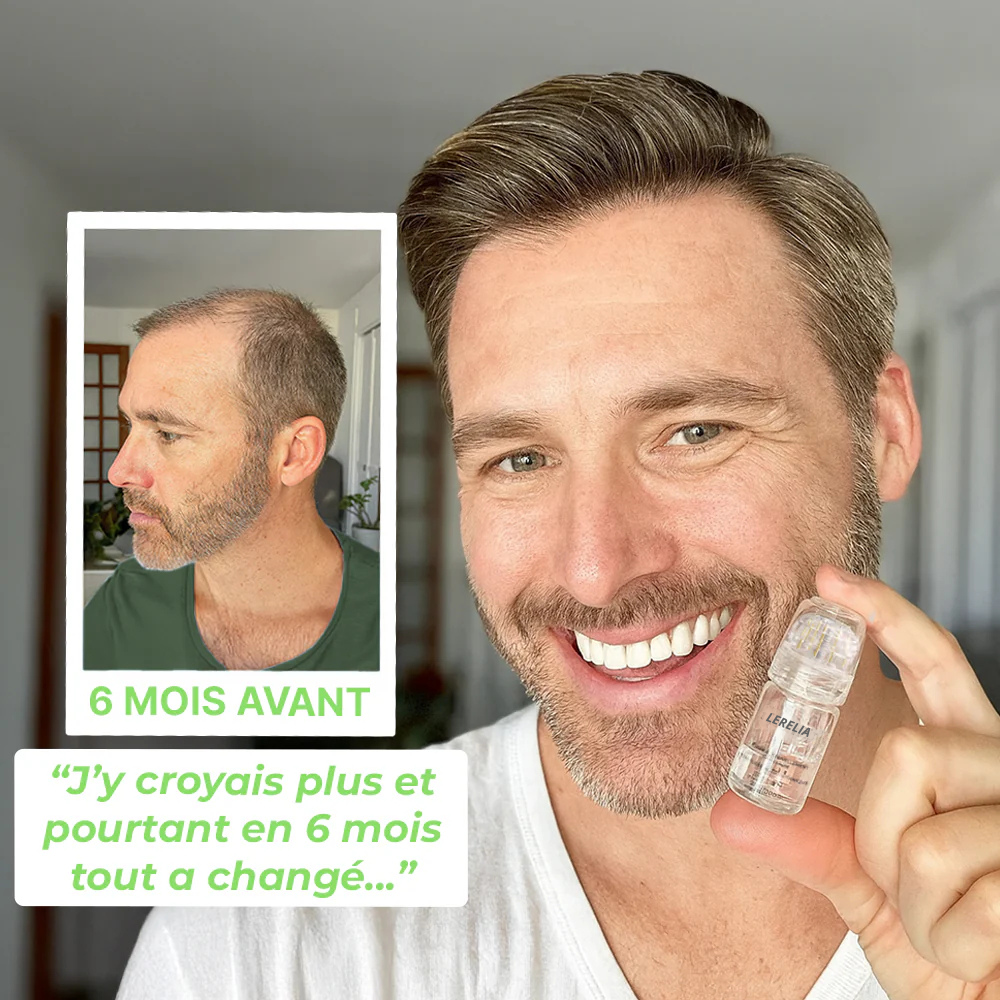 Système de Micro-Infusion Capillaire™ - Lerelia